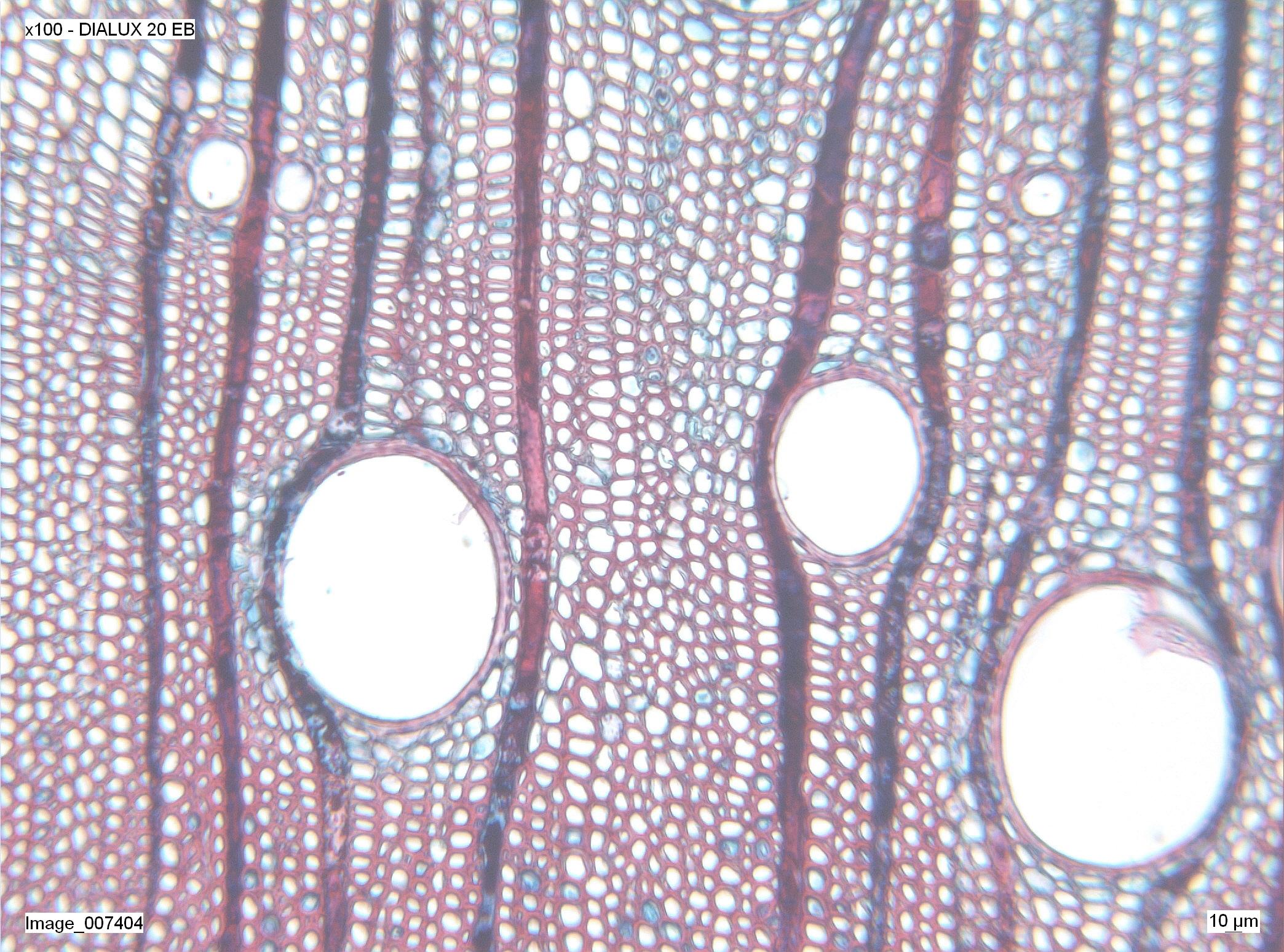 Eucalyptus globulus_CT